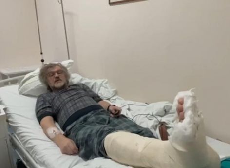 Эмир Кустурица не приедет на открытие «Духа огня» из-за перелома ноги