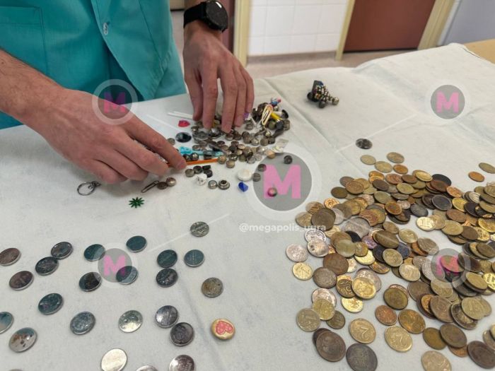 ​Нижневартовский врач показал коллекцию предметов, которые достал из детей