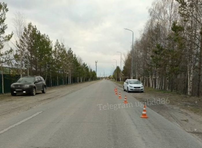 ​Югорчанка сбила 12-летнего ребенка ‒ школьник попал в больницу